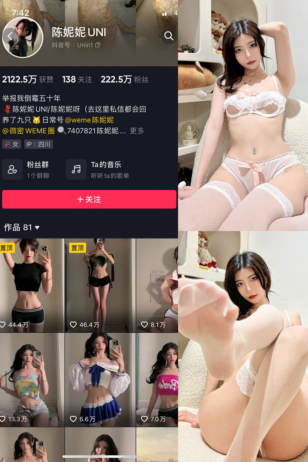 抖音 陈妮腻UNI 微密圈 NO.014期 【22P】