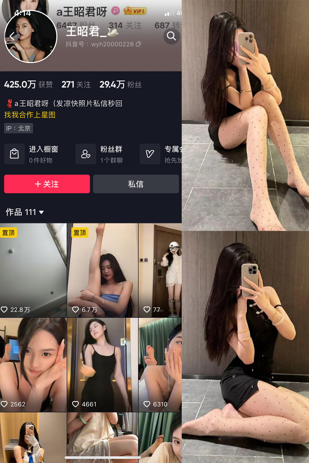 抖音 王昭君 微密圈 NO.022期 【25P6V】最新至：2024.3.13
