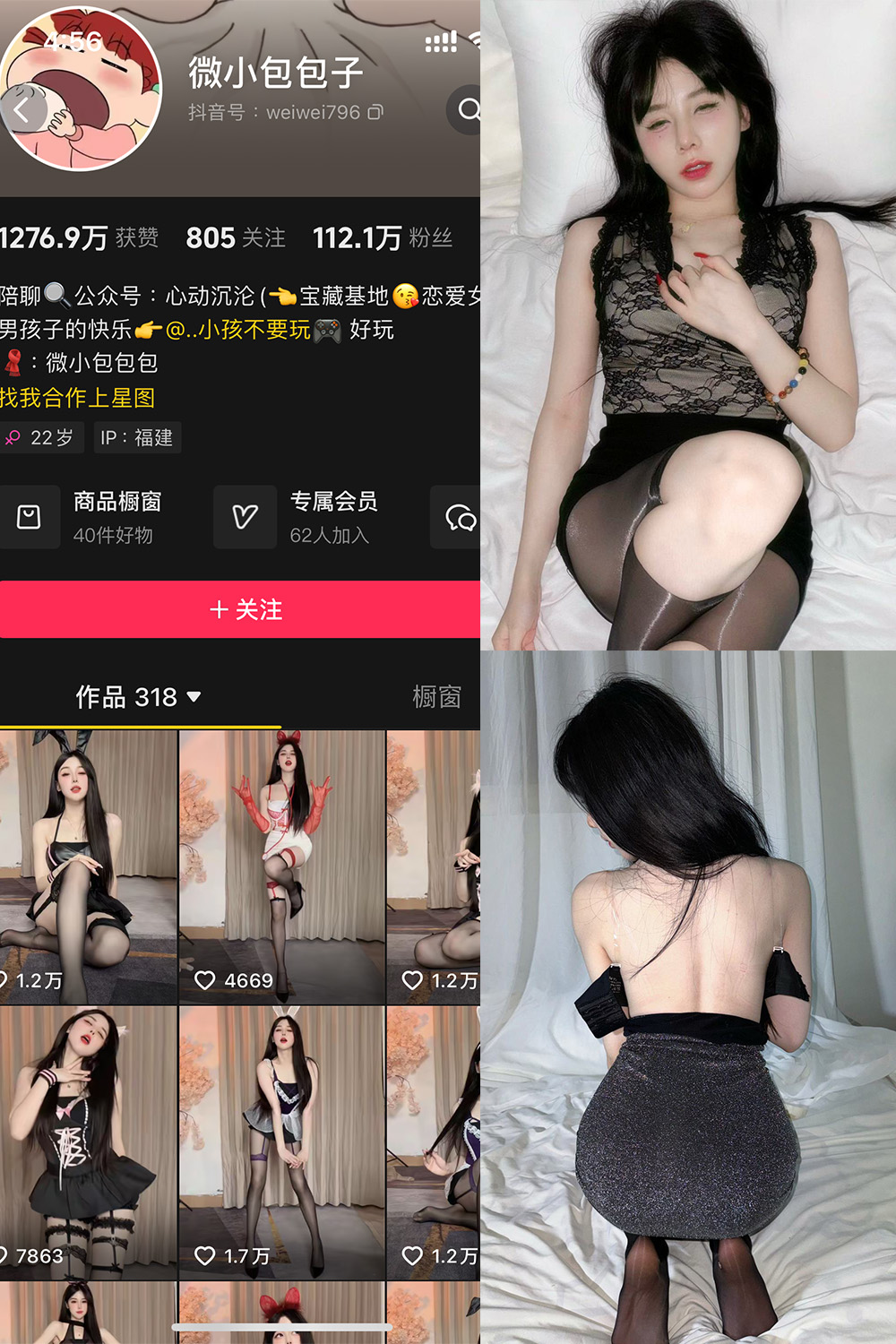 抖音 微小包包子 微密圈 NO.006期 【40P5V】最新至：