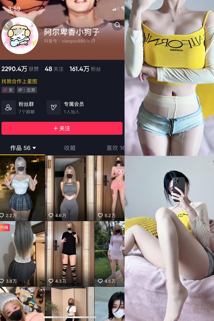抖音 阿尔卑香小狗子 微密圈 NO.032期 【22P】