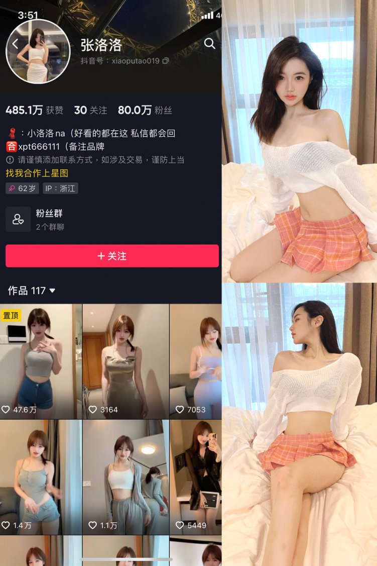 抖音 张洛洛 微密圈 NO.001期 【30P】