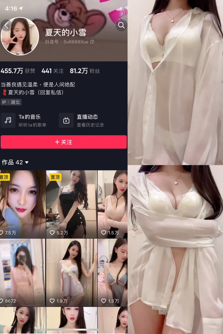 抖音 夏天的小雪 微密圈 嘉宾专享 NO.011期 【4P2V】最新至: