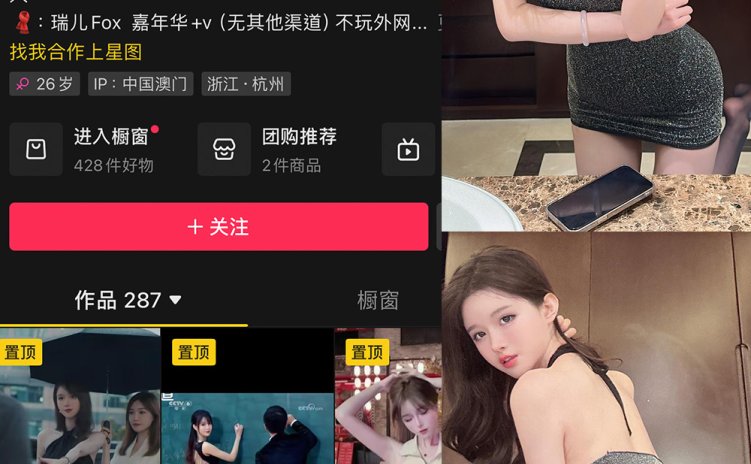 抖音 瑞儿fox 微密圈 NO.005期 【31P】最新至：2023.12.05