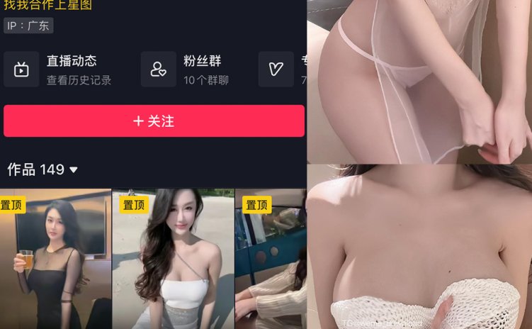 抖音 琳琳小公主 微密圈 002 期 【31P1V】