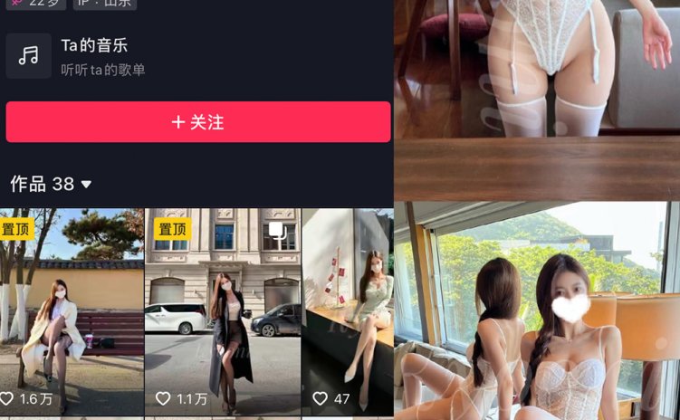 抖音 Yooni有你喵 微密圈 NO.012期 【26P】