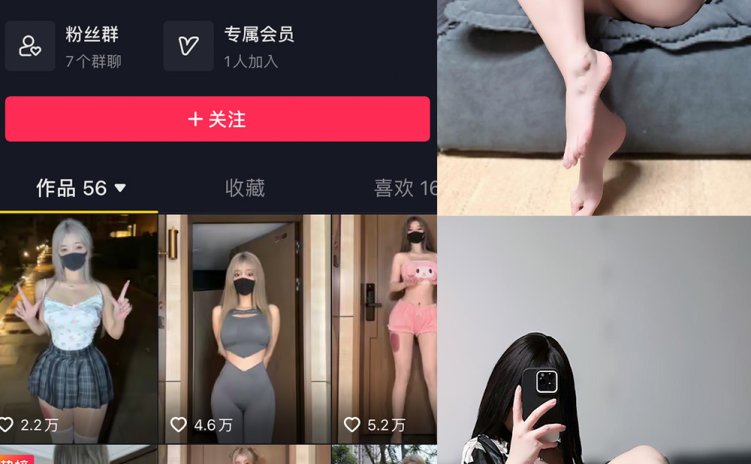 抖音 阿尔卑香小狗子 微密圈 NO.037期 【21P】最新至：