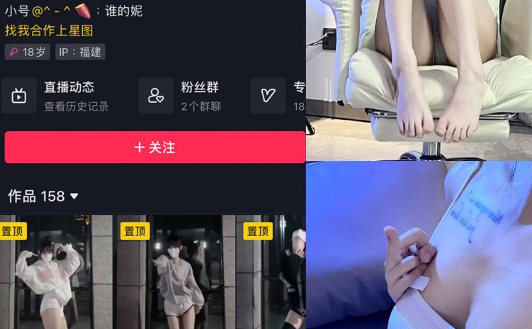 抖音 妮老师 微密圈 NO.002期 【5P2V】最新至：2023.6.28