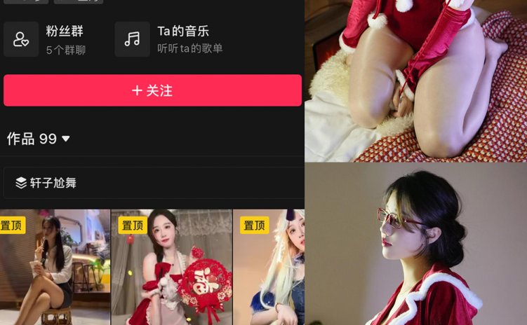 抖音 轩子巨二兔 微密圈 NO.021期 【22P】最新至：2024.1.24
