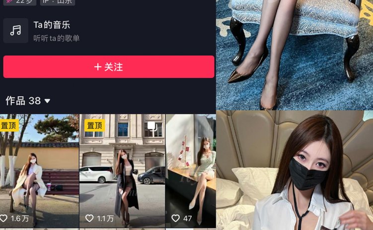 抖音 Yooni有你喵 微密圈 NO.011期 【24P】