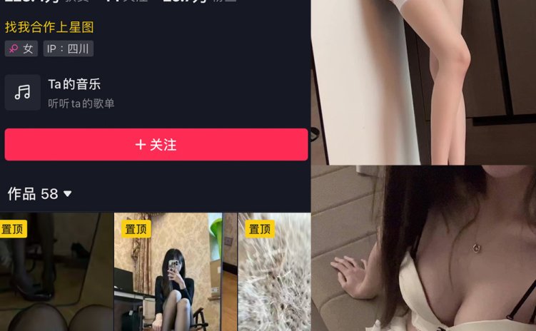 抖音 辛普森的兔子 微密圈 NO.049期 【6P26V】最新至：
