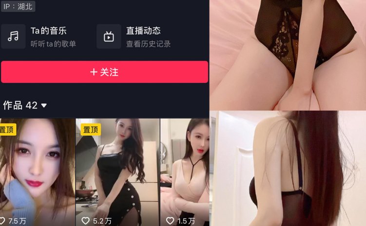 抖音 夏天的小雪 微密圈 嘉宾专享 NO.007期 【20P4V】