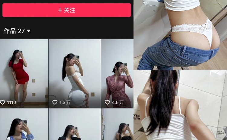 抖音 音音 微密圈 NO.008期 【102P5V】
