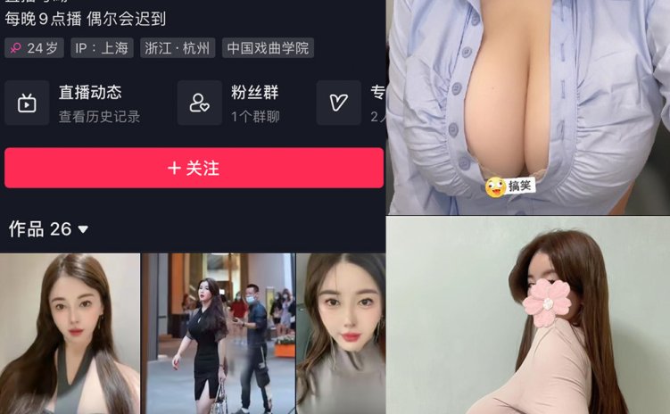 抖音 猪小七 微密圈 NO.003期 【28P13V】