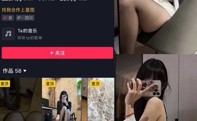 抖音 辛普森的兔子 微密圈 NO.047期 【9P7V】最新至：