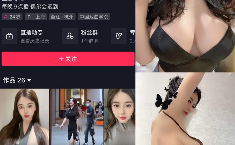 抖音 猪小七 微密圈 NO.001期 【47P8V】