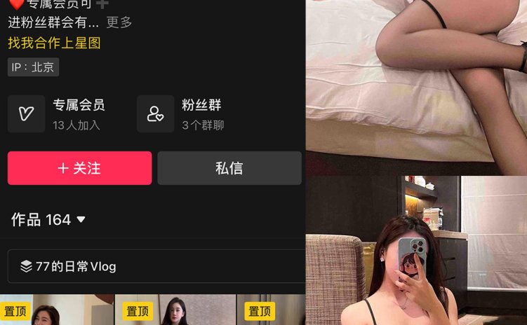 抖音 一只77 微密圈 NO.005期 【36P1V】最新至:2024.3.19