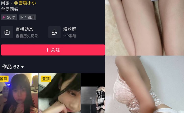 抖音 雪嘤公主 微密圈 NO.007期 【24V】最新至：2023.10.25