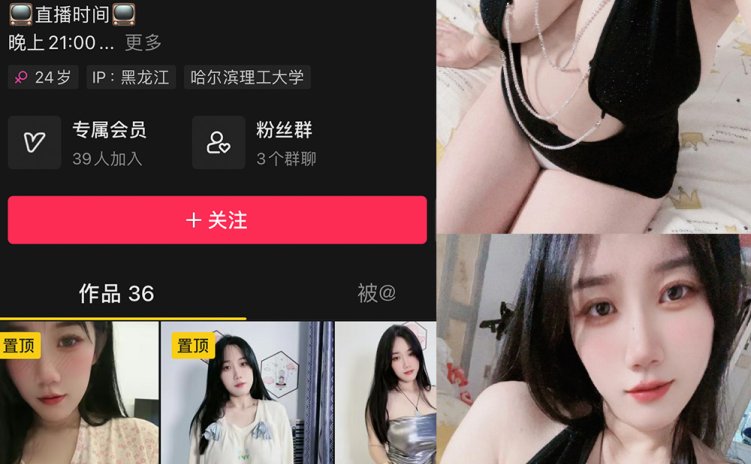 抖音 于丰霖 微密圈 NO.004期 【24P】最新至:2024.3.15