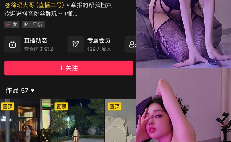 抖音 徐珺大哥 微密圈 NO.015期 【33P】最新至:2024.3.4