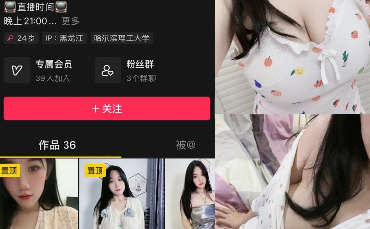 抖音 于丰霖 微密圈 NO.003期 【66P4V】
