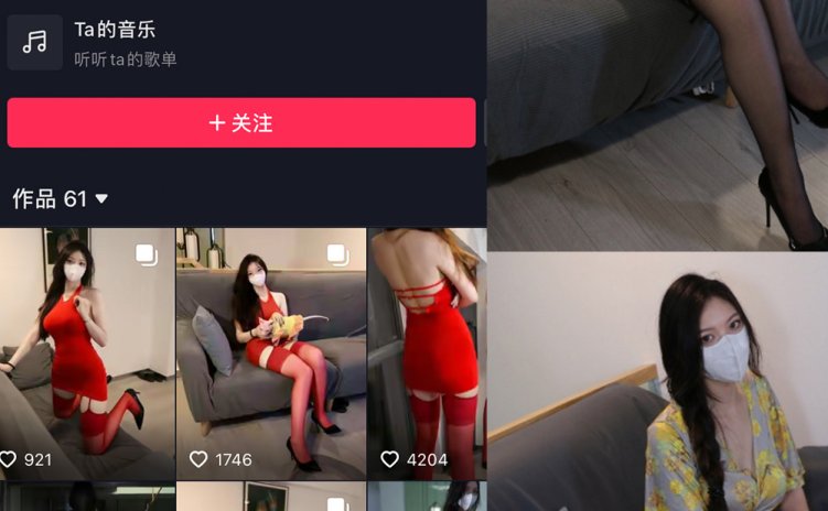 抖音 唯一甜甜圈 微密圈 NO.005期 【24P5V】