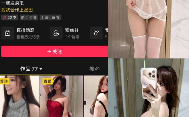 抖音 奔跑的晶骡子 微密圈 NO.009期 【51P】