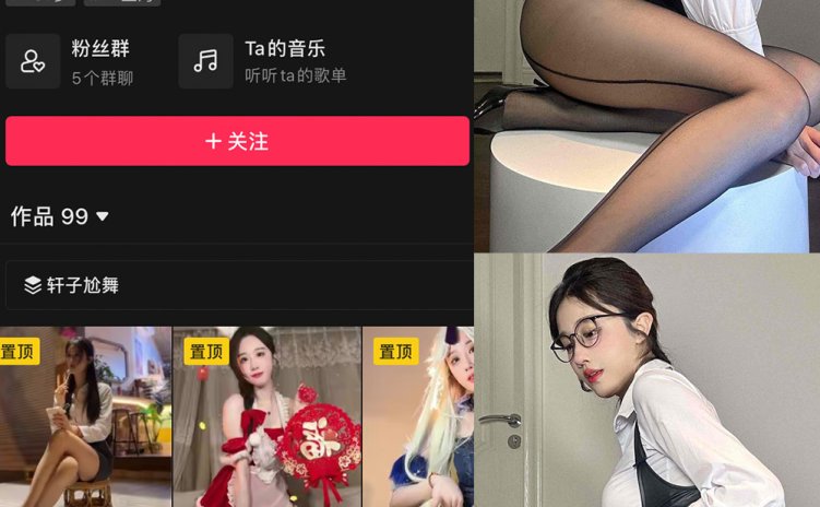 抖音 轩子巨二兔 微密圈 NO.013期 【25P4V】最新至：