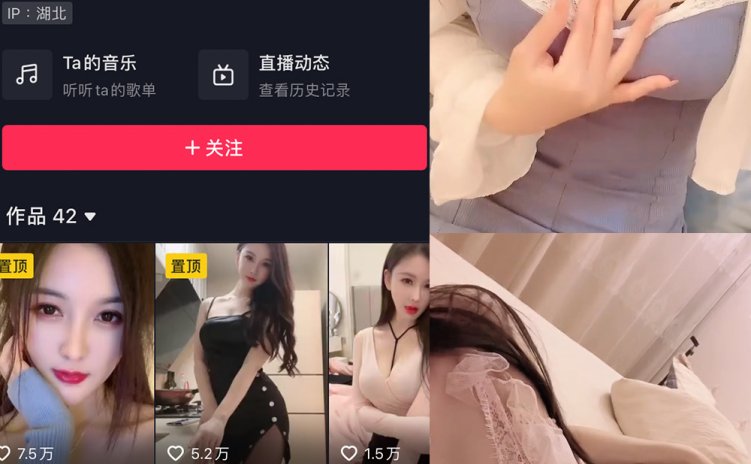 抖音 夏天的小雪 微密圈 嘉宾专享 NO.009期 【13P13V】最新至：