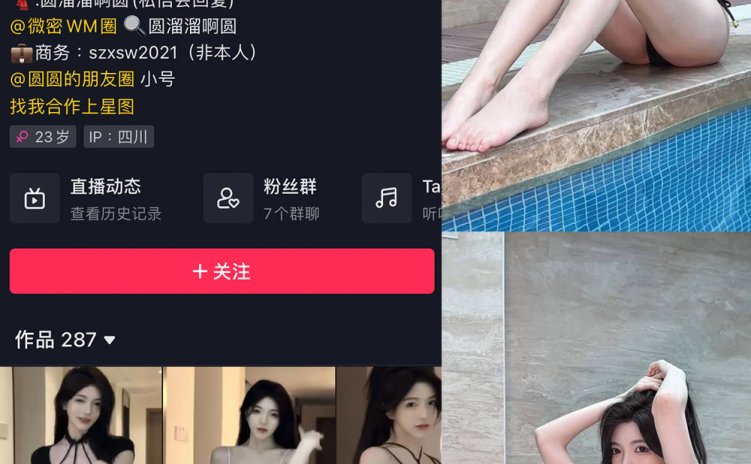 抖音 圆溜溜阿圆 微密圈 NO.002期 【24P1V】