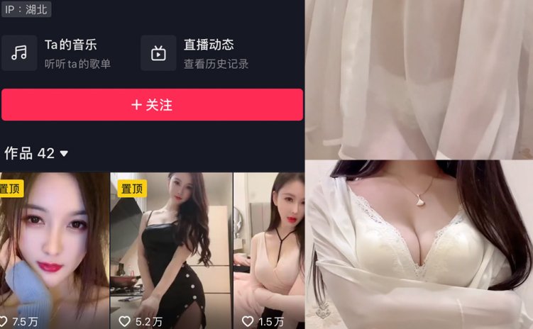 抖音 夏天的小雪 微密圈 嘉宾专享 NO.011期 【4P2V】最新至：