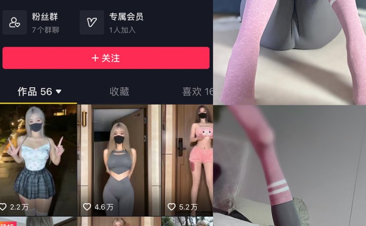 抖音 阿尔卑香小狗子 微密圈 NO.038期 【10P】最新至：