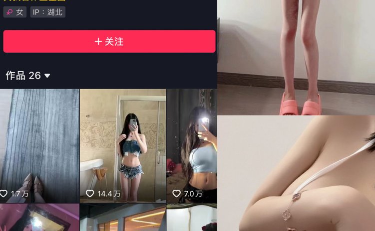 抖音 沈汝凡超甜 微密圈 NO.006期 【31P8V】