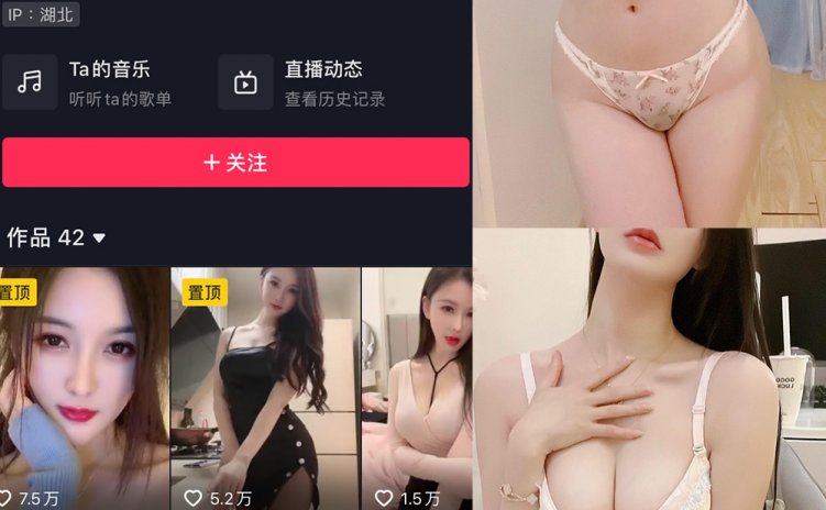 抖音 夏天的小雪 微密圈 嘉宾专享 NO.014期 【6P】最新至：
