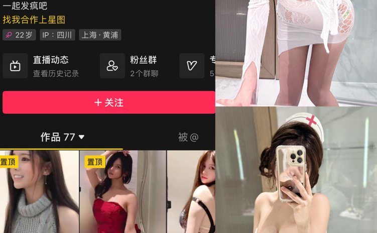 抖音 奔跑的晶骡子 微密圈 NO.007期 【56P1V】