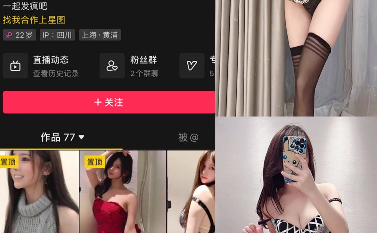 抖音 奔跑的晶骡子 微密圈 NO.002期 【229P4V】