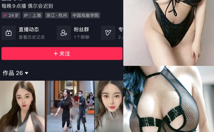 抖音 猪小七 微密圈 NO.005期 【93P13V】