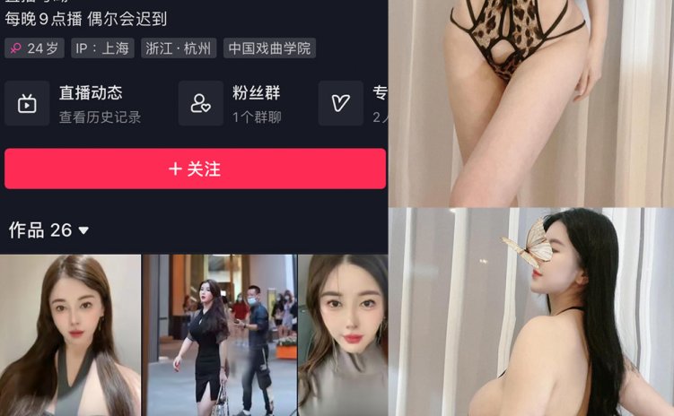 抖音 猪小七 微密圈 NO.006期 【76P17V】