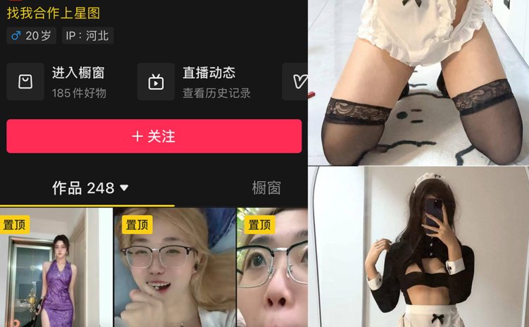 抖音 学中医的土狗 微密圈 NO.001期 【5P6V】最新至：