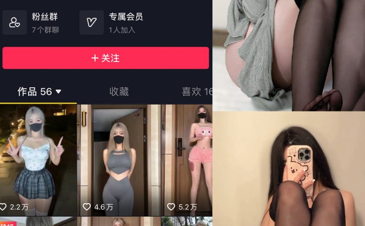 抖音 阿尔卑香小狗子 微密圈 NO.042期 【6P1V】最新至：