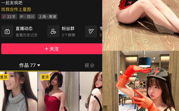抖音 奔跑的晶骡子 微密圈 NO.006期 【86P】最新至：
