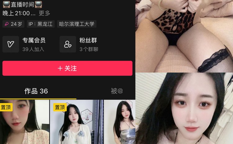 抖音 于丰霖 微密圈 NO.002期 【61P13V】