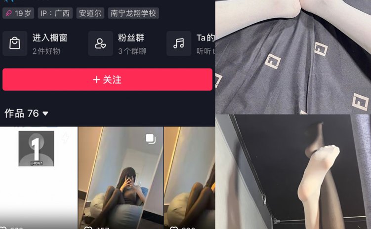抖音 娇七 微密圈 NO.004期 【63P】