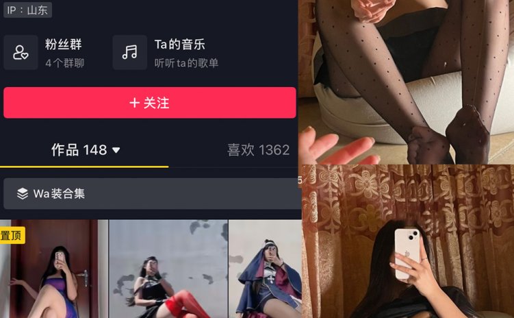 抖音 美邵女Baby 微密圈 NO.006期 【35P】