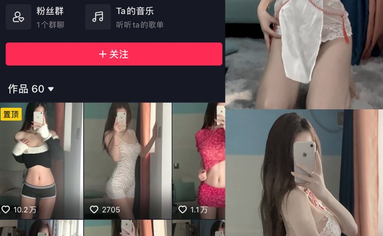 抖音 腩腩 微密圈 NO.001期 【14P】最新