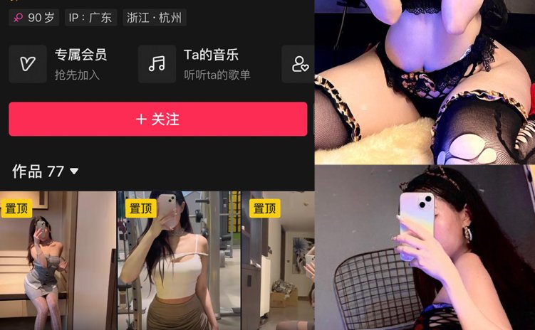 抖音 小喵咪ck 微密圈 NO.001期 【83P1V】