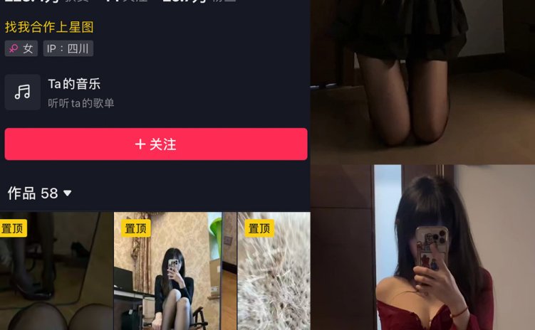抖音 辛普森的兔子 微密圈 NO.052期 【3P9V】最新至