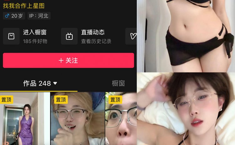 抖音 学中医的土狗 微密圈 NO.002期 【11P1V】最新