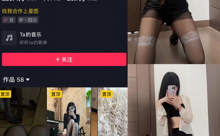 抖音 辛普森的兔子 微密圈 NO.054期 【2P8V】最新至：2024.5.6