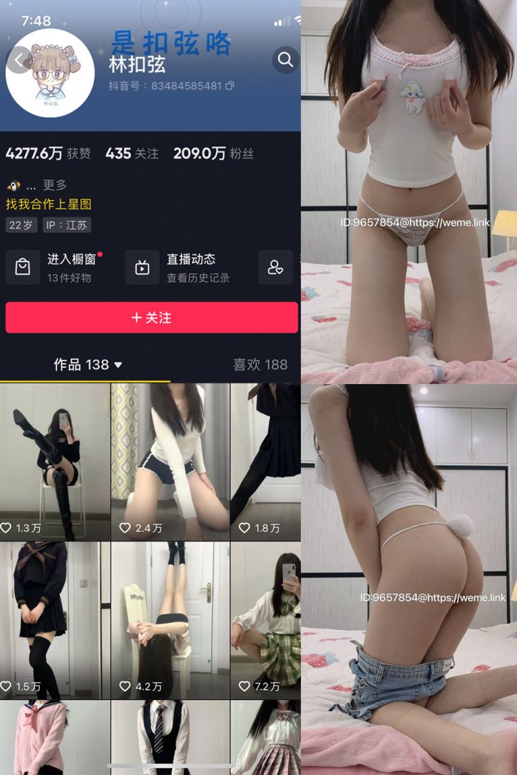 抖音 林扣弦 微密圈 NO.070期 【25P】