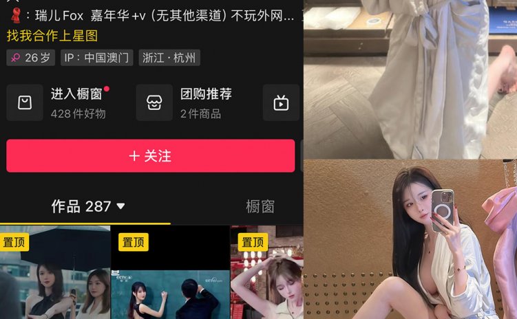 抖音 瑞儿fox 微密圈 NO.007期 【25P】